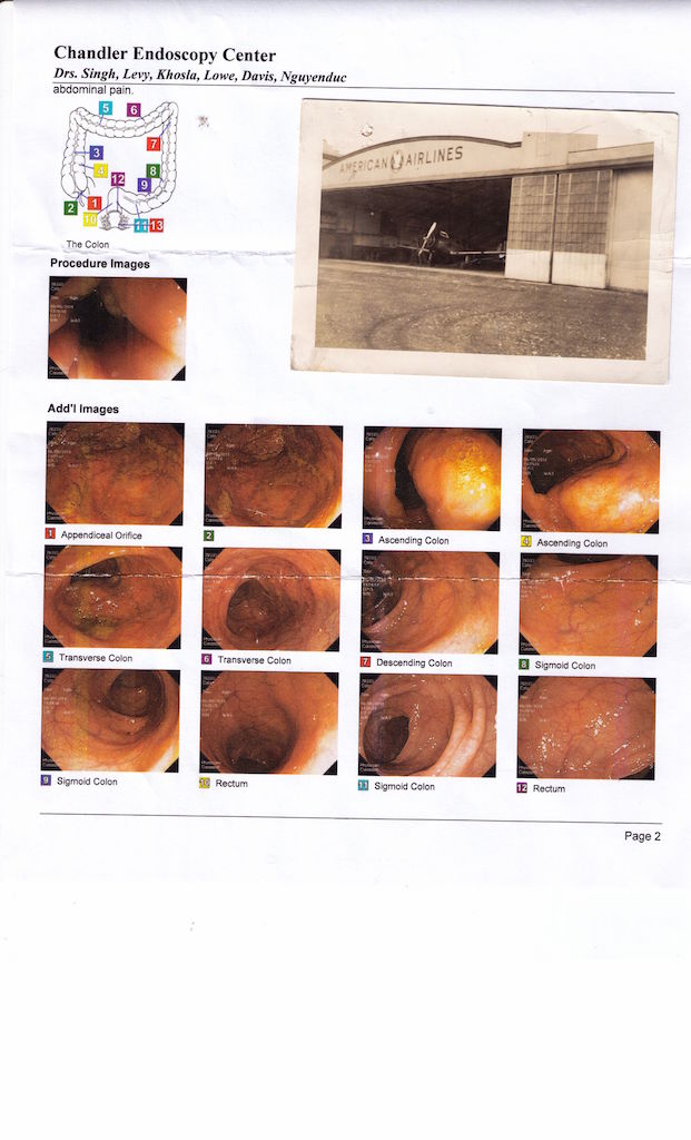 colonoscopy-findings-colonoscopy-crohns-disease-ulcerative-colitis